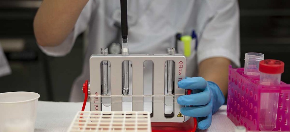 Κορωνοϊός: Πειραματικό τεστ αίματος ανιχνεύει τους ασθενείς που κινδυνεύουν να νοσήσουν σοβαρά