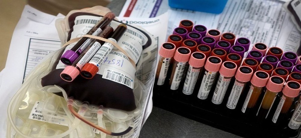 Έως 35% μειώθηκε η συμμετοχή στις αιμοδοσίες: Έκκληση για δωρεά αίματος