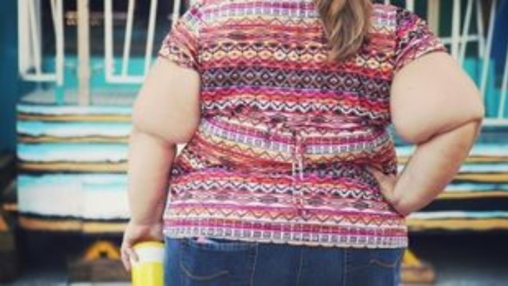 Κορωνοϊός: Νέα στοιχεία επιβεβαιώνουν ότι οι παχύσαρκοι κινδυνεύουν περισσότερο