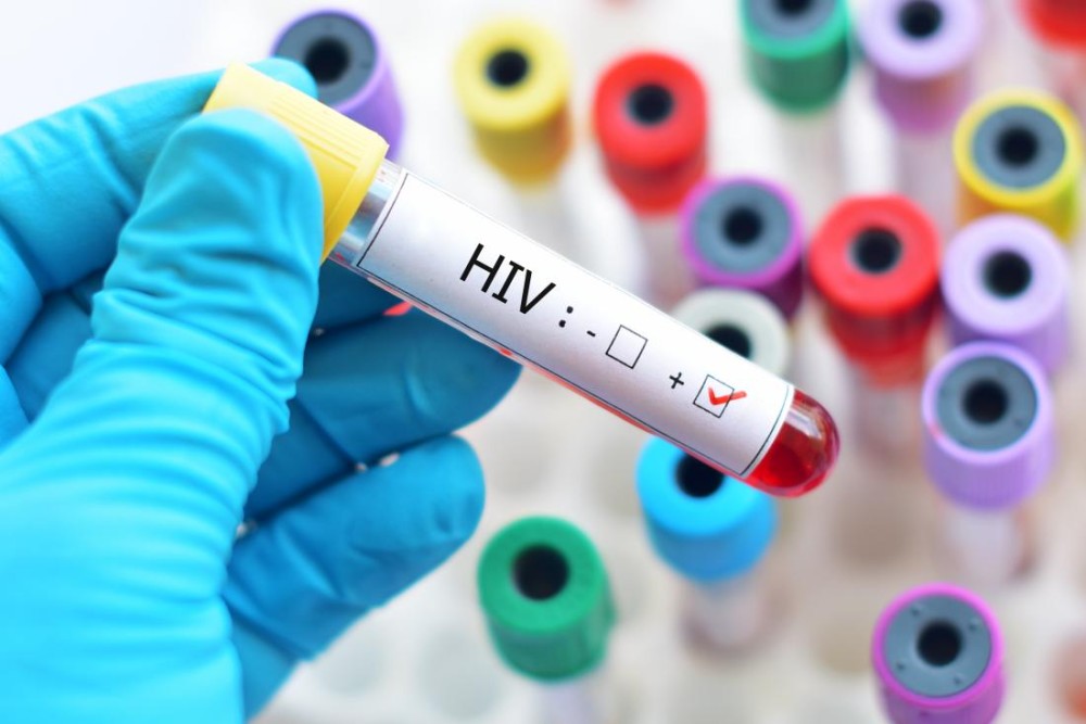 Ανακαλύφθηκε μια ακόμη γενετική μετάλλαξη που προκαλεί ανοσία στον HIV