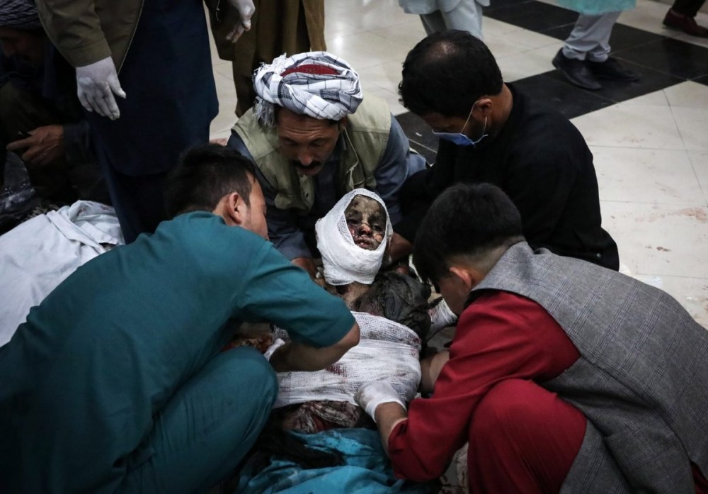 Αφγανιστάν: 68 οι νεκροί από τη χθεσινή (8&#x2F;5) βομβιστική επίθεση