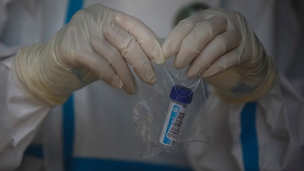 Πώς ξεκίνησε η πανδημία;-Τρεις ερευνητές στην Ουχάν είχαν συμπτώματα από το 2019