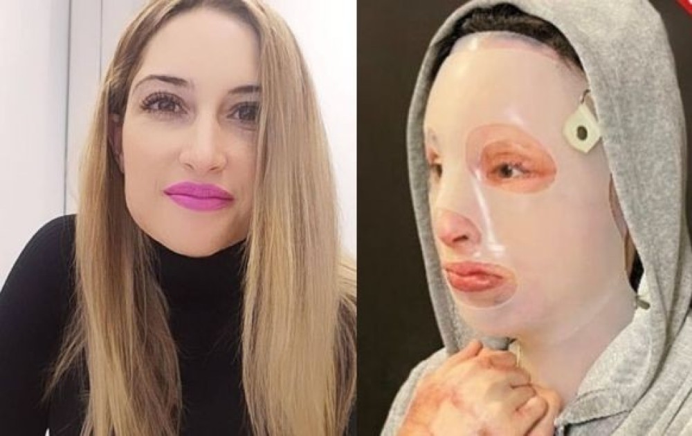 Ιωάννα Παλιοσπύρου – Δημοσίευσε σοκαριστικές φωτογραφίες μετά την επίθεση με το βιτριόλι (σκληρές εικόνες)