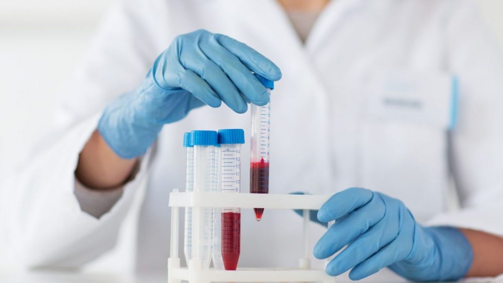 Νέο βρετανικό τεστ αίματος ανιχνεύει τον καρκίνο σε ασυμπτωματικούς ανθρώπους