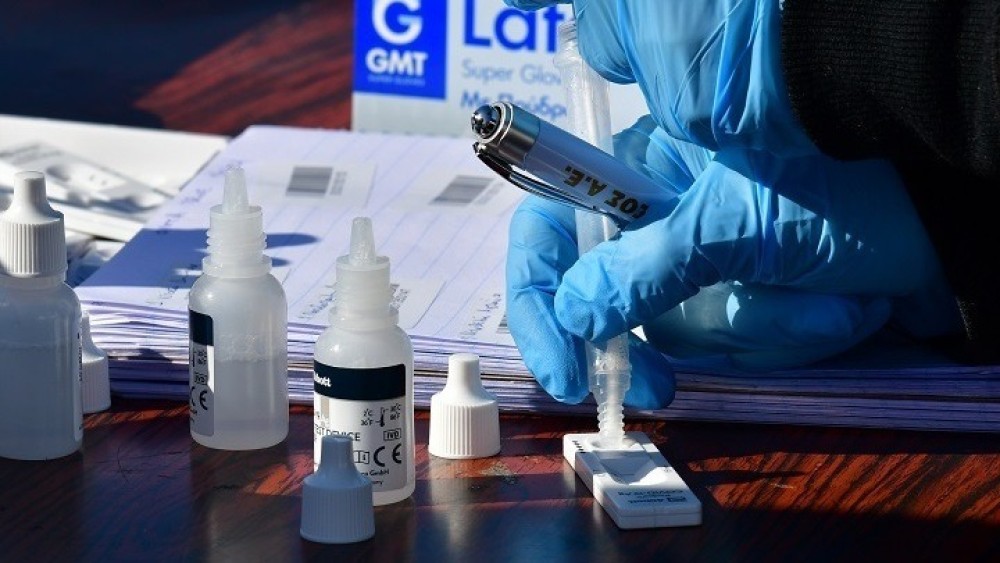 Πρόστιμο 5.000 ευρώ για μη τήρηση του το πλαφόν σε PCR και rapid tests