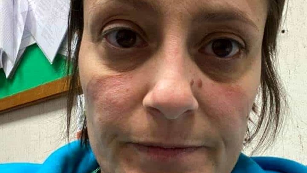 Vivian Perniciaro: Η Ιταλίδα γιατρός που έγινε το viral «πρόσωπο» του κορωνοϊού