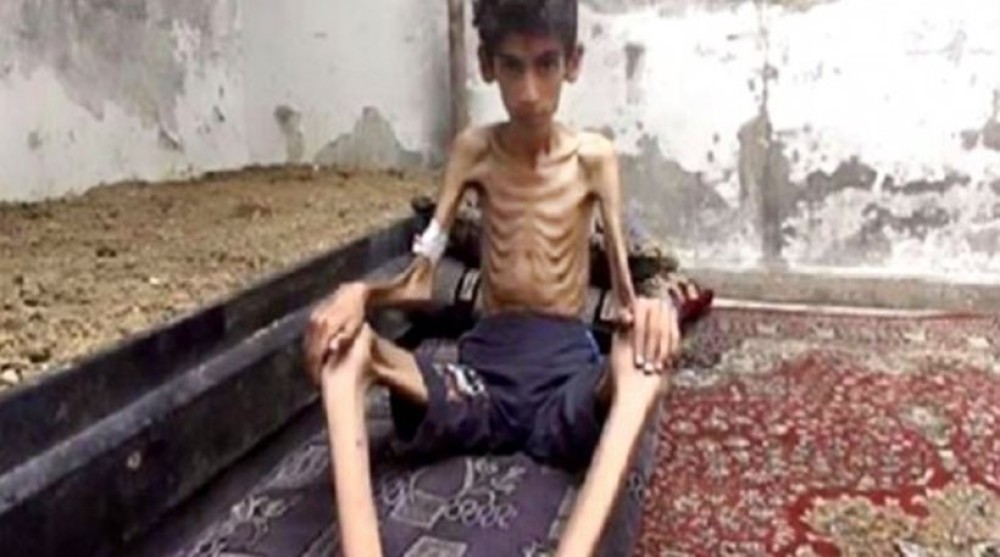 Συρία-ΟΗΕ: 9,3 εκατομμύρια άνθρωποι δεν έχουν να φάνε