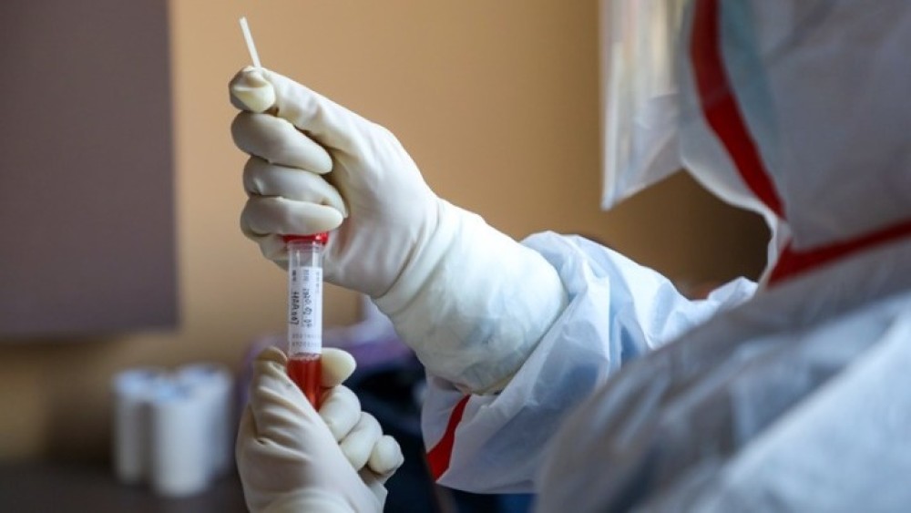 Γαλλία: Αντισώματα απέκτησε το 26% σε εστία επιδημίας κορωνοϊού
