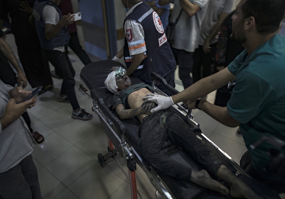 Επεμβάσεις χωρίς αναισθησία στα νοσοκομεία της Γάζας - Αδιανόητος πόνος για τα μικρά παιδιά