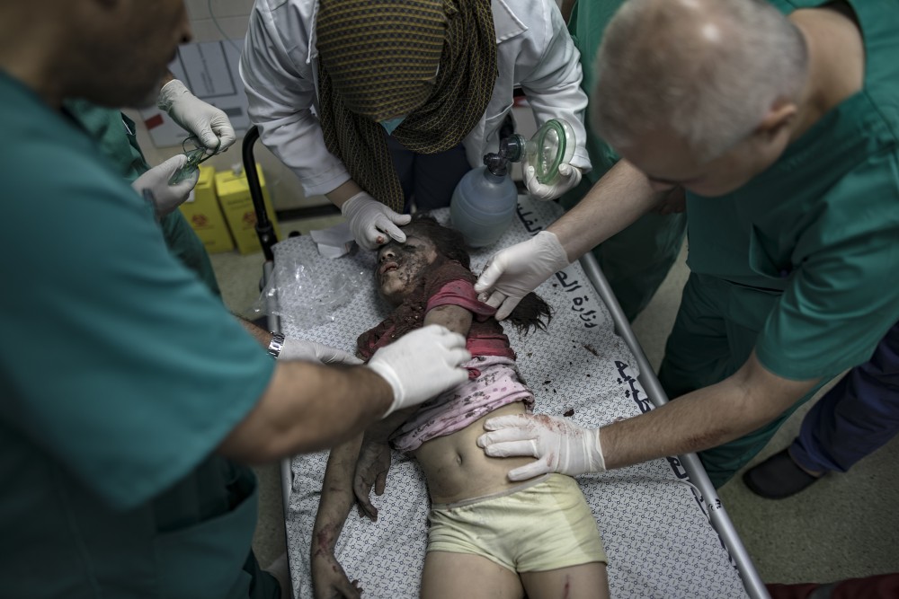 «Ξαναβάλτε μου τα πόδια μου»: η φρίκη των ακρωτηριασμένων παιδιών στη Γάζα