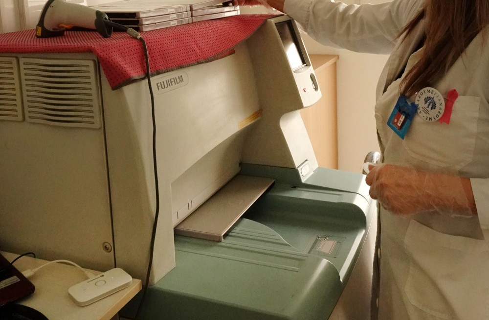 Eurostat: πρώτη η Ελλάδα σε διαθεσιμότητα μηχανημάτων μαστογραφίας στην ΕΕ