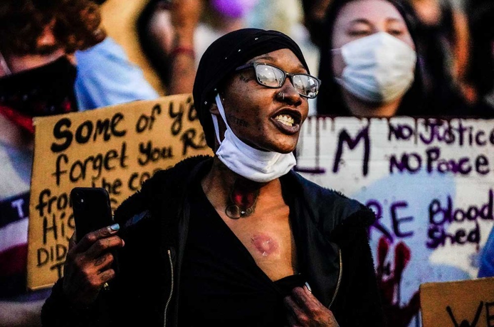 ΗΠΑ: Πυροβολισμοί κατά διαδηλωτών στο Ουισκόνσιν &#8211; Ένας νεκρός (vid)