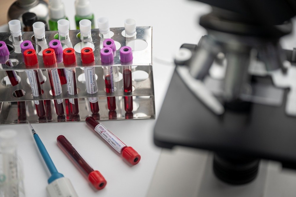 Κορωνοϊός: Στο τελευταίο στάδιο κλινικών δοκιμών το εμβόλιο της AstraZeneca